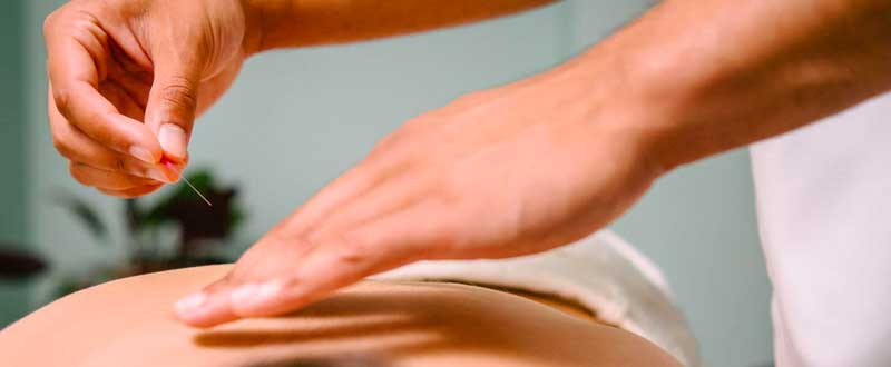acupuncture in waterloo